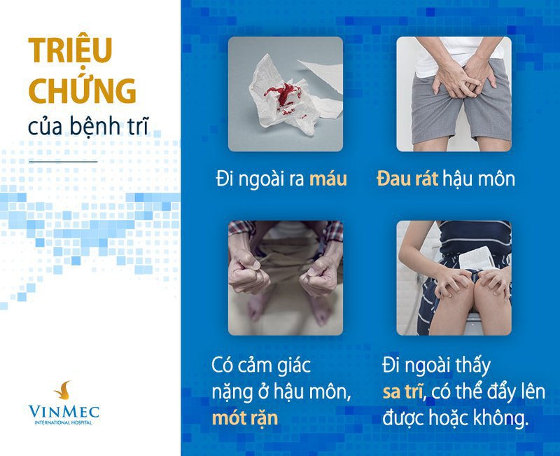 Trĩ ngoại
